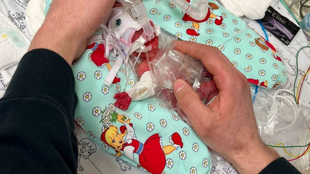 Passau: "Ein kleines Wunder": Baby überlebt trotz 265 Gramm Geburtsgewicht