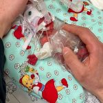 Passau: "Ein kleines Wunder": Baby überlebt trotz 265 Gramm Geburtsgewicht