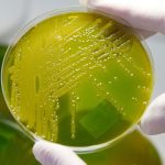 Lebensmittel-Rückruf: Zwiebelmettwurst wegen Ehec-Gefahr zurückgerufen