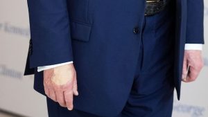 US-Präsident: Flecken an Trumps Hand – das steckt laut Weißem Haus dahinter