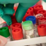 WHO hebt höchste Alarmstufe für Infektionskrankheit Mpox auf