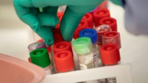 WHO hebt höchste Alarmstufe für Infektionskrankheit Mpox auf