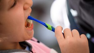 Zahngesundheit: Karies bei Kita-Kindern soll früher erkannt werden