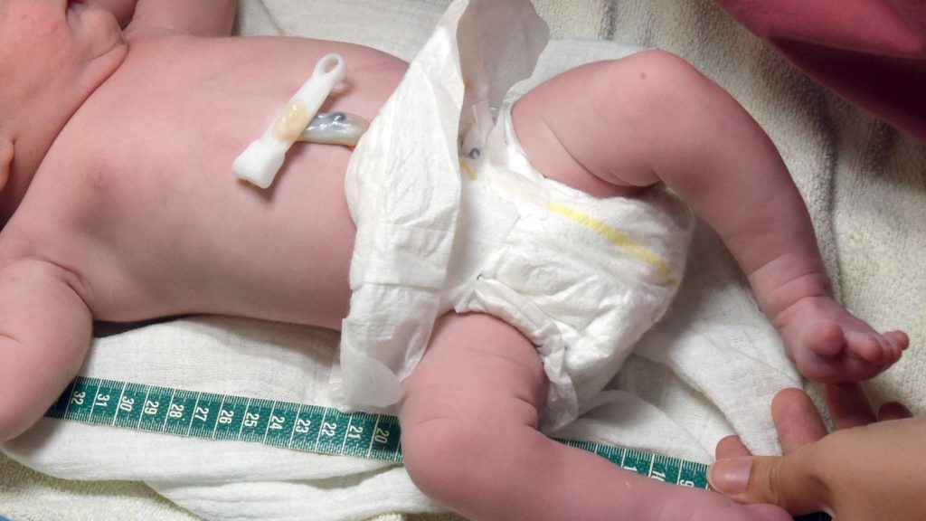 Geburtshilfe: Weniger Geld für Hebammen: Kreißsaalschließungen befürchtet