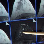 Medizin: Hohe Kosten: Land erwägt Reform der Krebsregistrierung